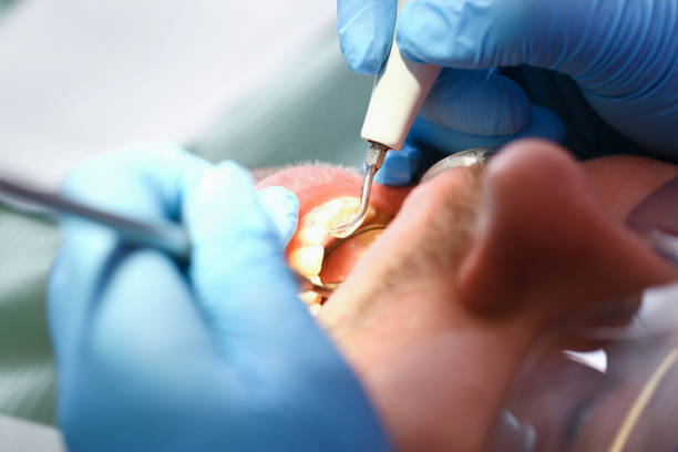 Best Emergency Dentist Near Me  in Caldwell, OH