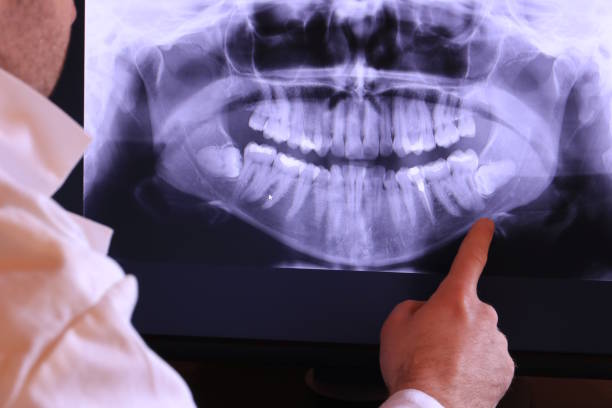 Best Emergency Dental Services Near Me  in Caldwell, OH