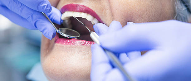 Best Urgent Dental Care  in Caldwell, OH